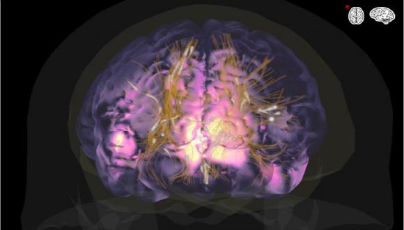 סמינר  “RECENT ADVANCES IN COMPUTATIONAL  ELECTROMAGNETICS FOR HIGH  RESOLUTION NEUROIMAGING”